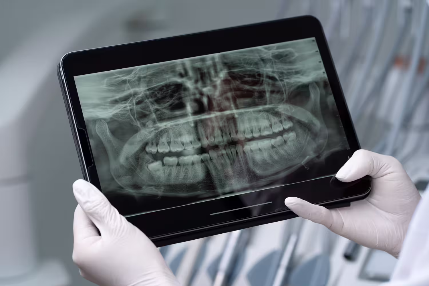 Dental Exams and Cleaning | Flourish Dental
