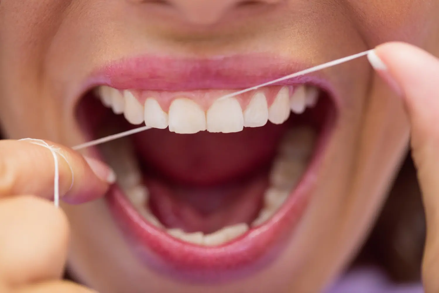 Dental Exams and Cleaning | Flourish Dental
