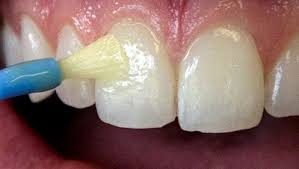 Dental Exams and Cleaning | Flourish Dental