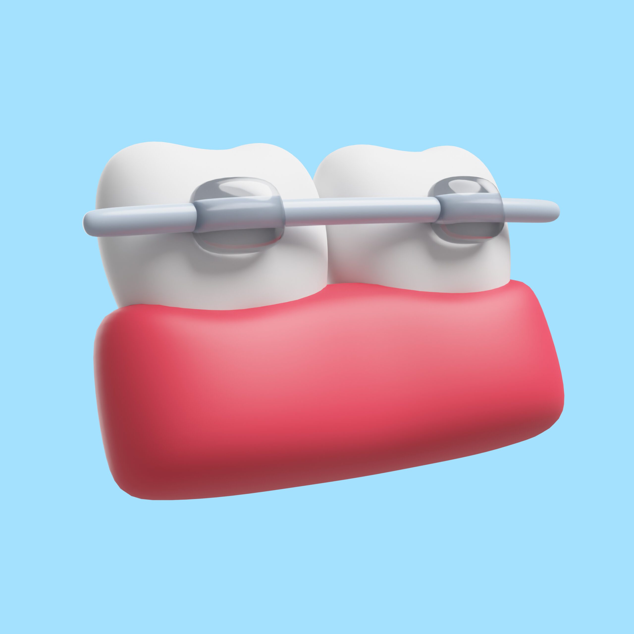 8323906 Braces | Flourish Dental